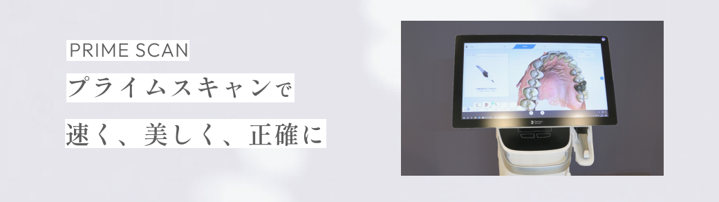 プライムスキャンで早く、美しく、正確に